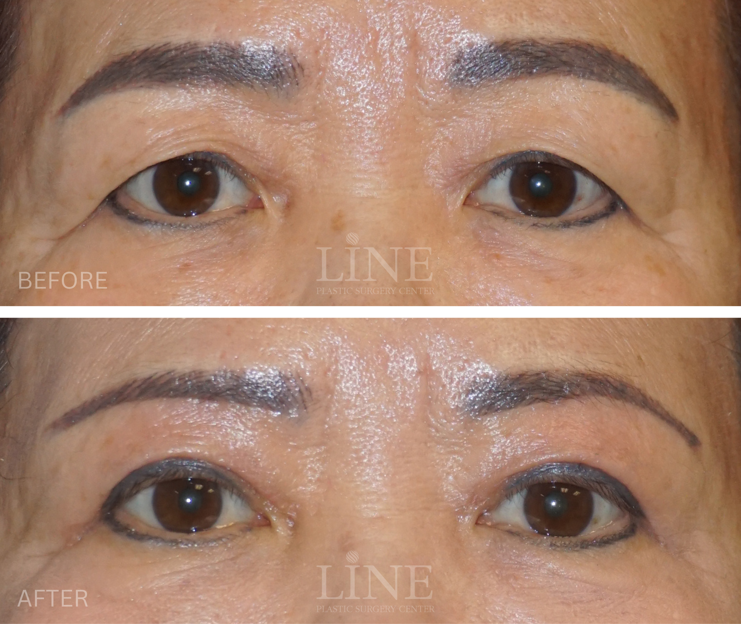EYE_BROW (1)
