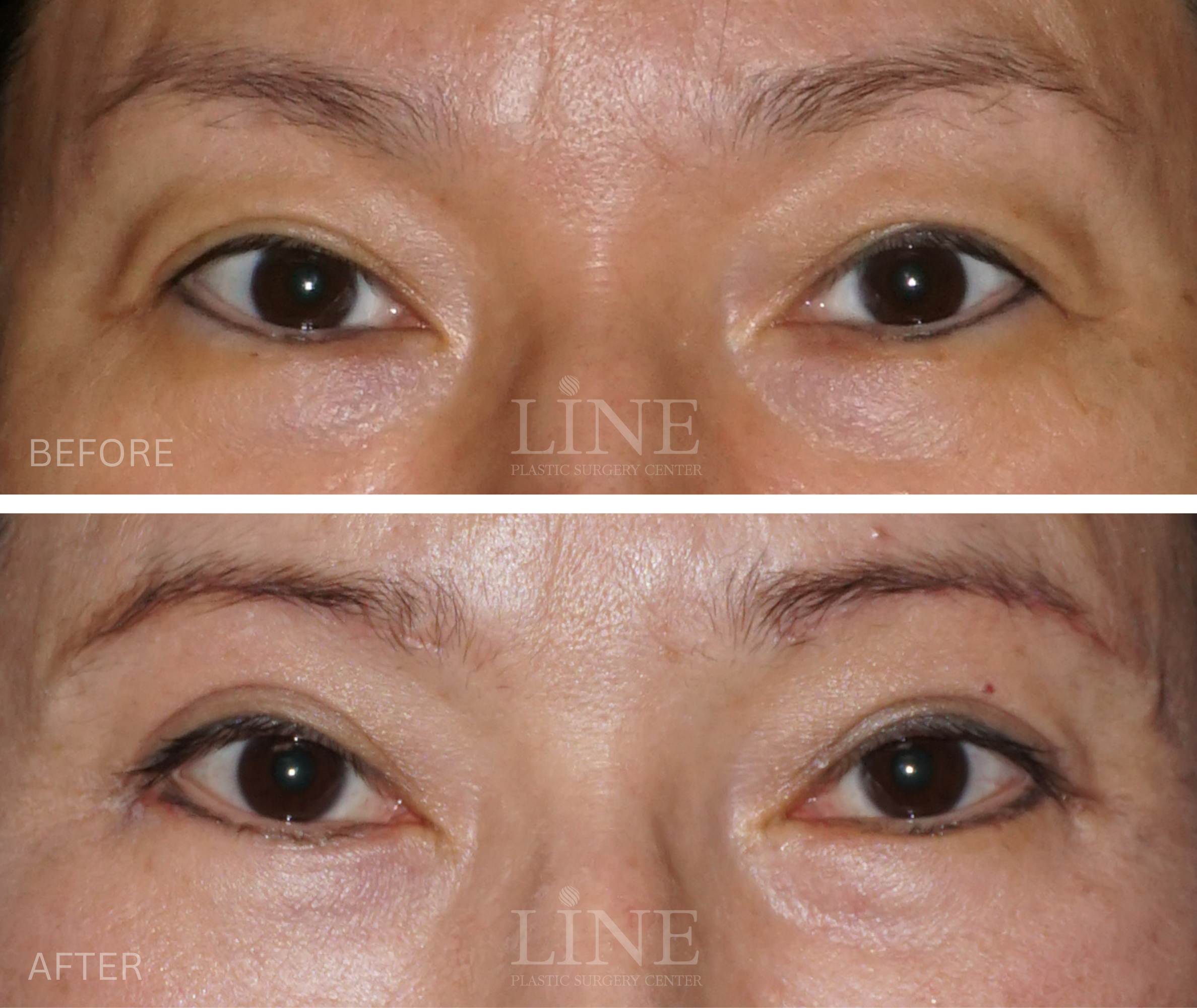 EYE_BROW (10)