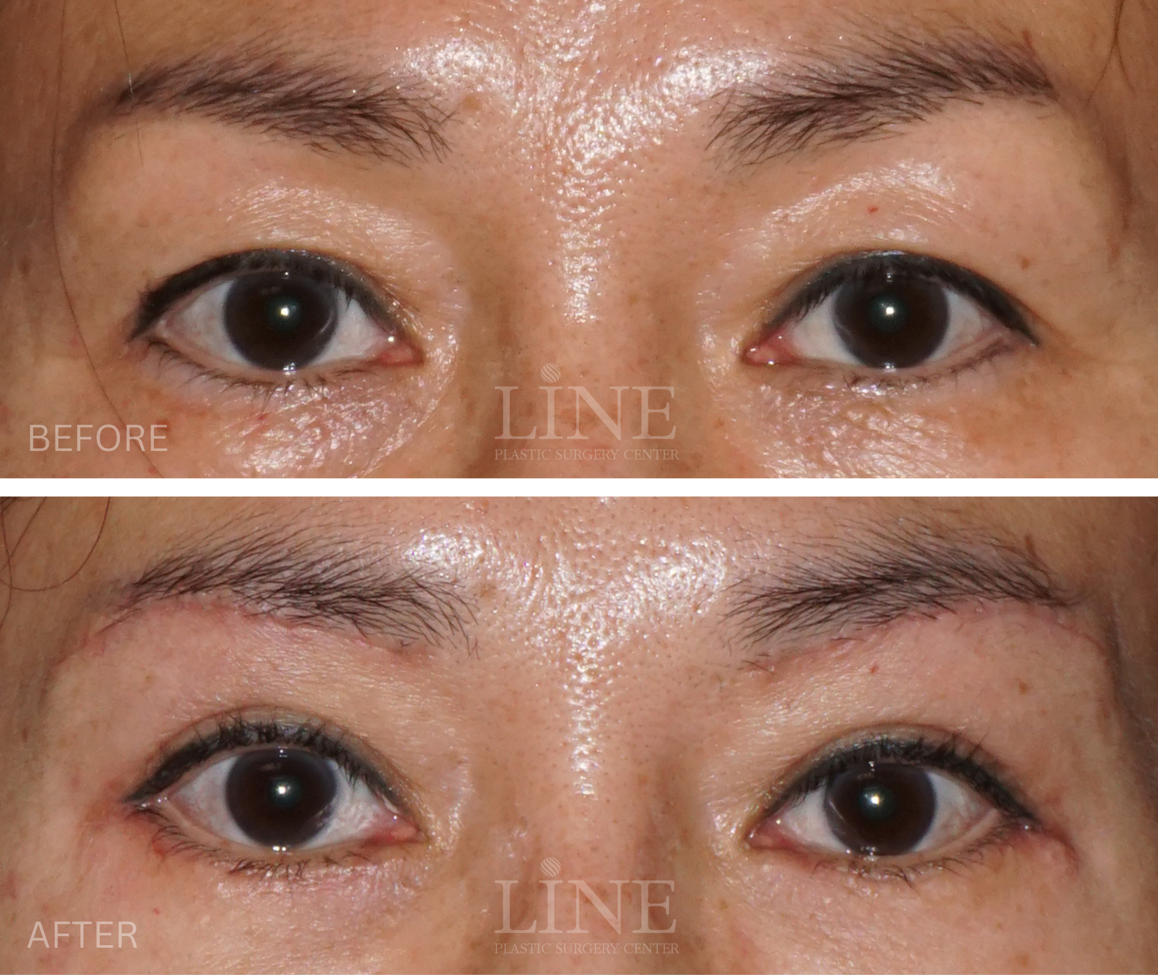 EYE_BROW (11)