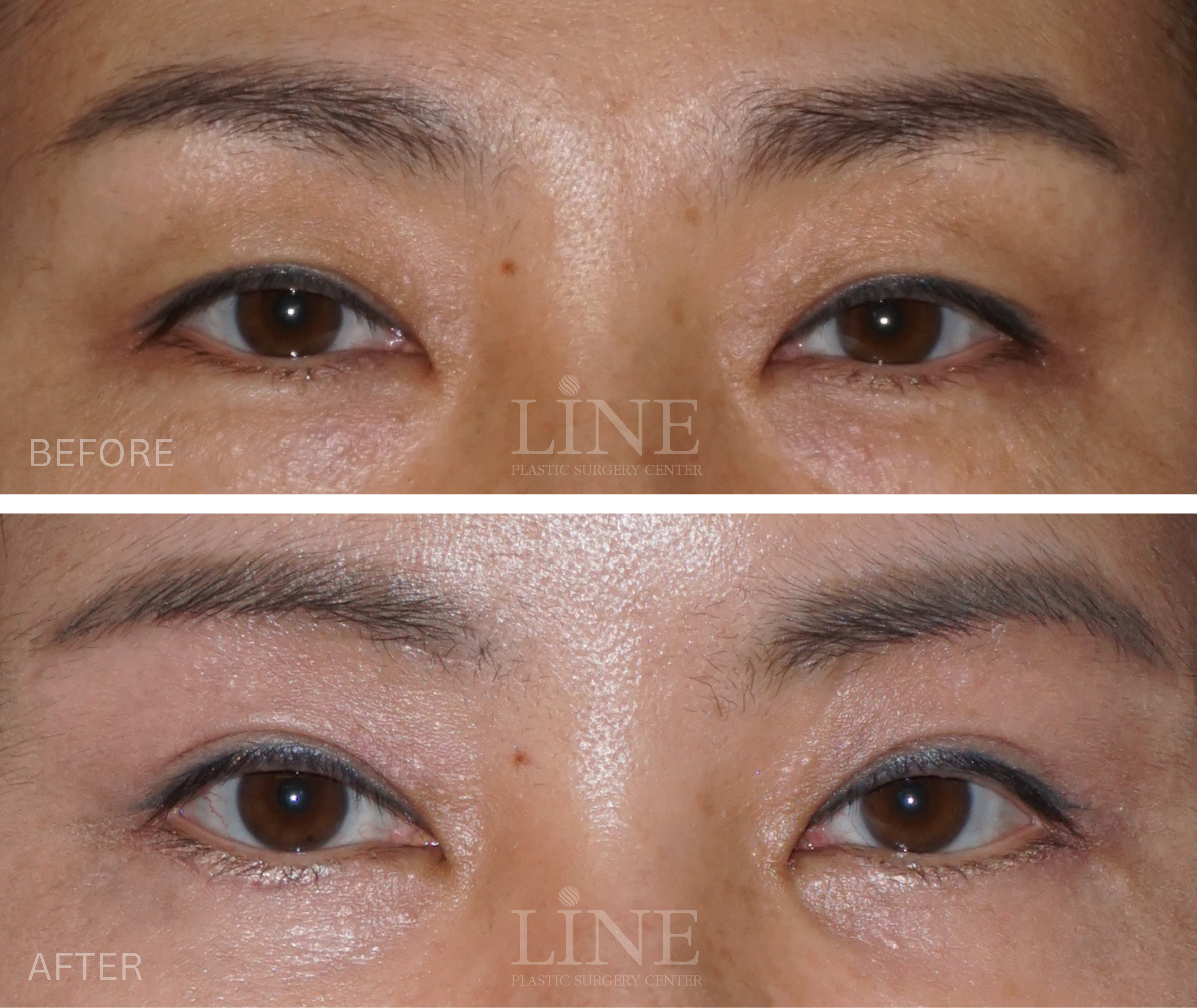 EYE_BROW (12)