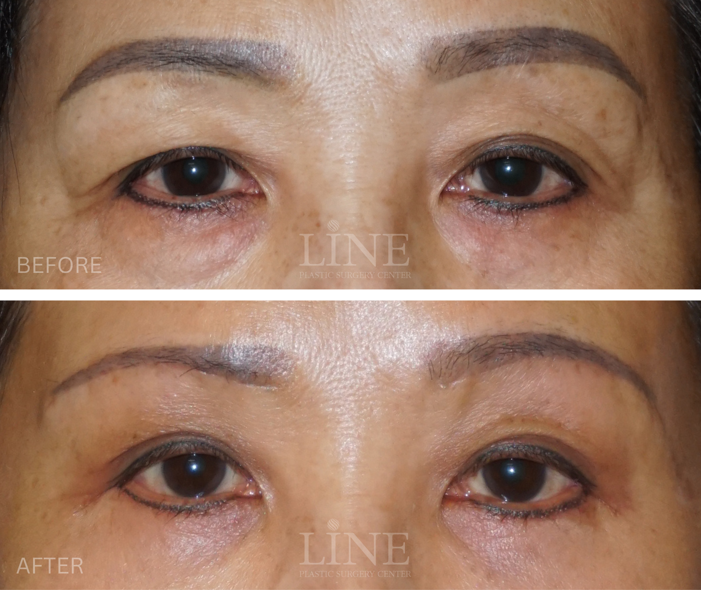 EYE_BROW (13)