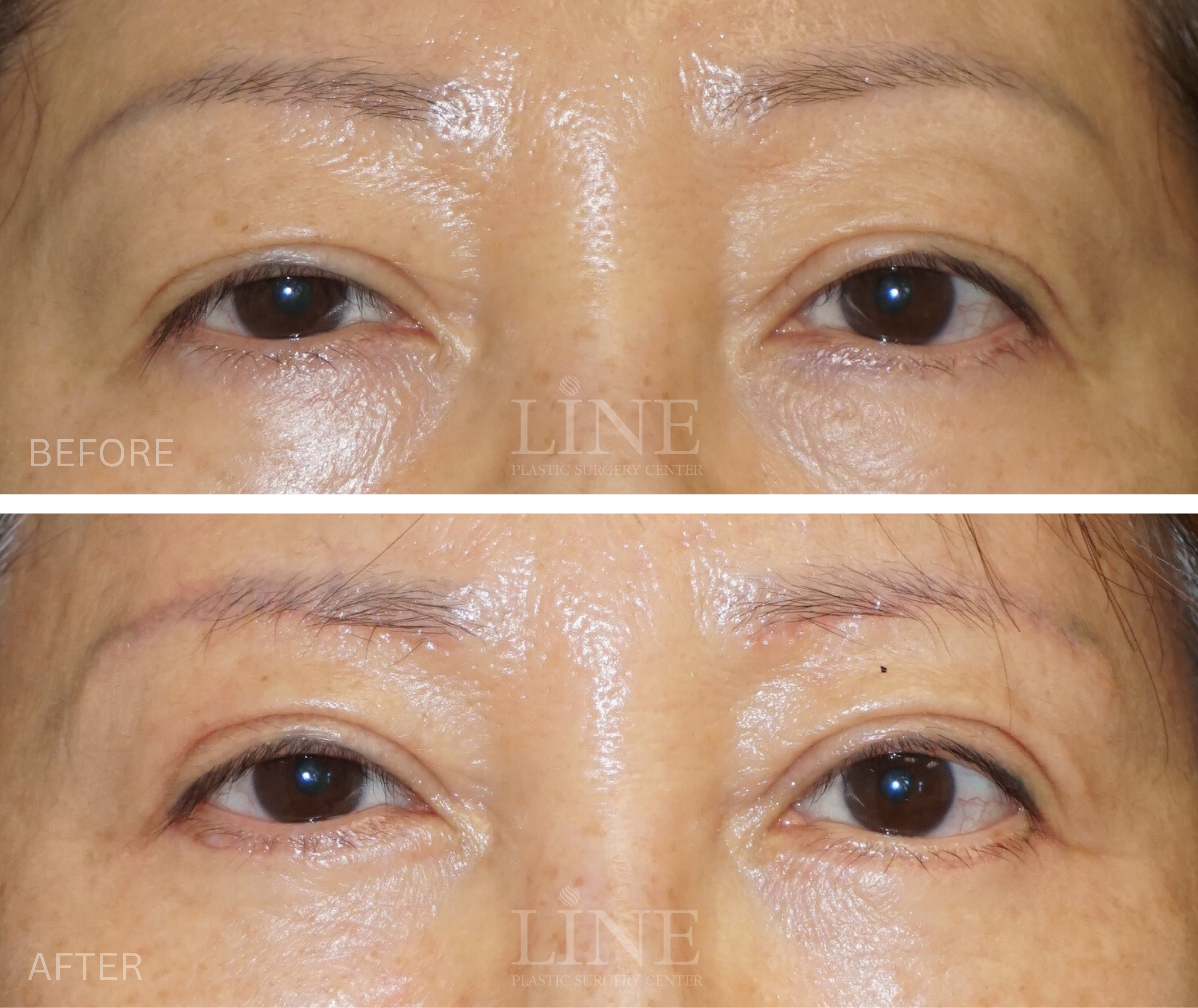 EYE_BROW (14)