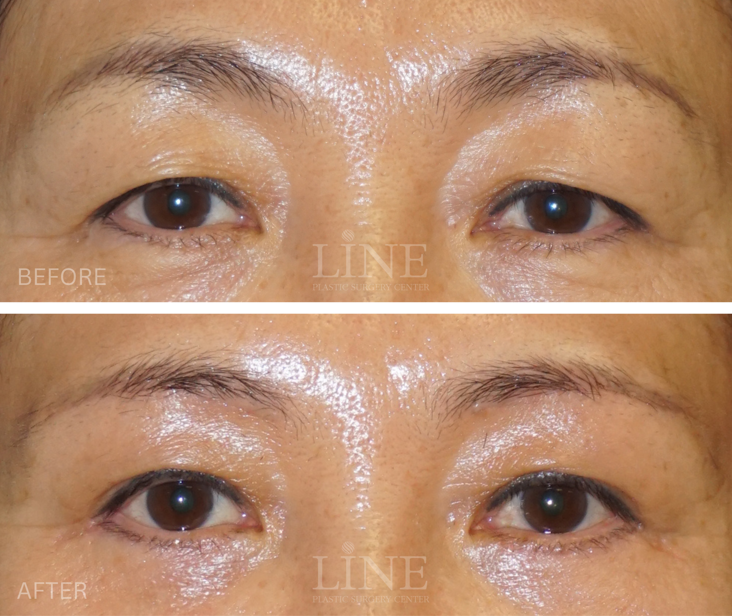 EYE_BROW (15)
