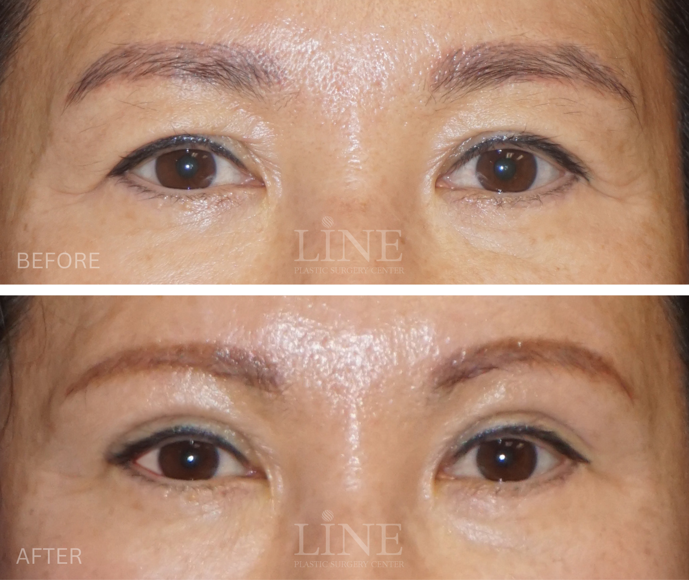 EYE_BROW (16)