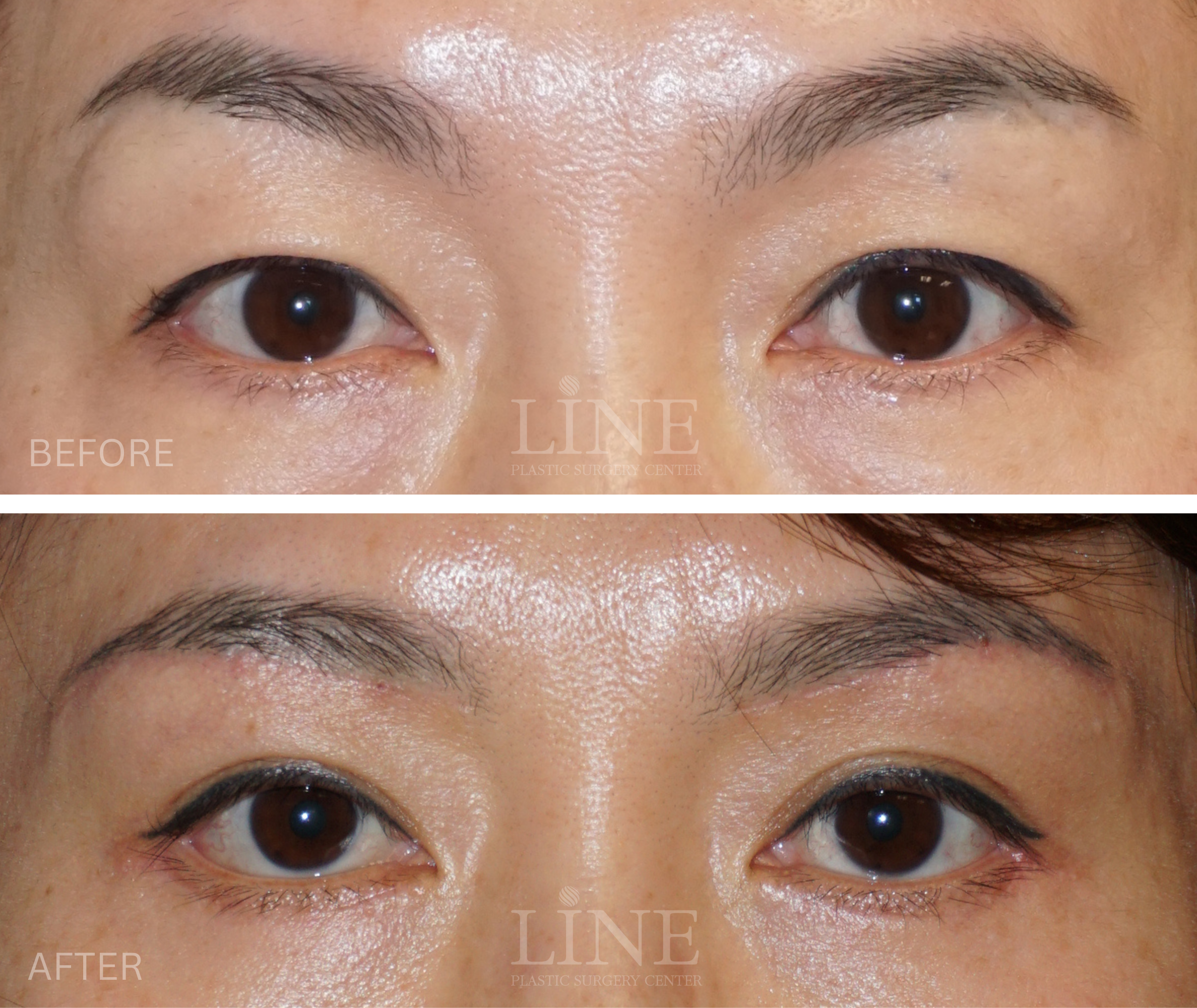 EYE_BROW (2)