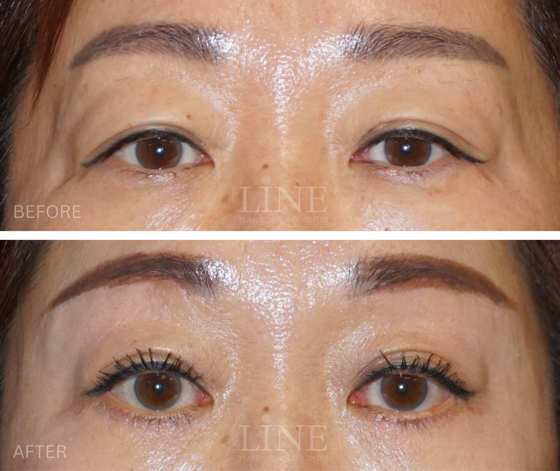 EYE_BROW (3)