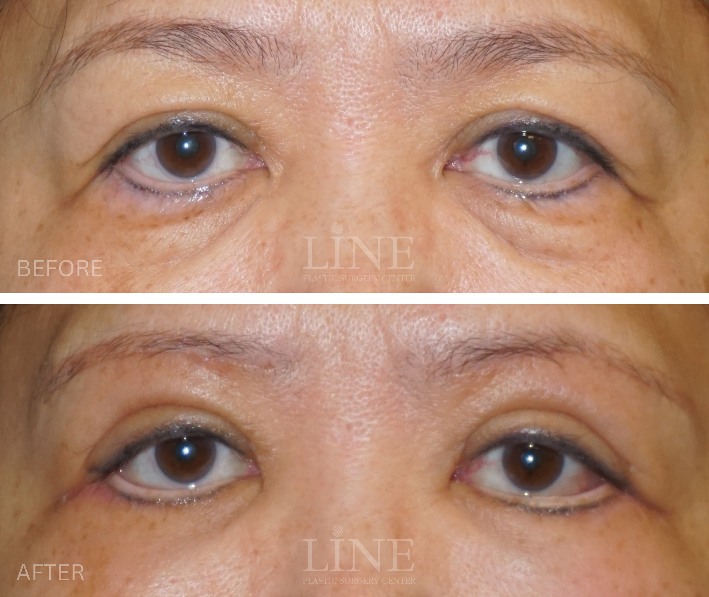EYE_BROW (4)