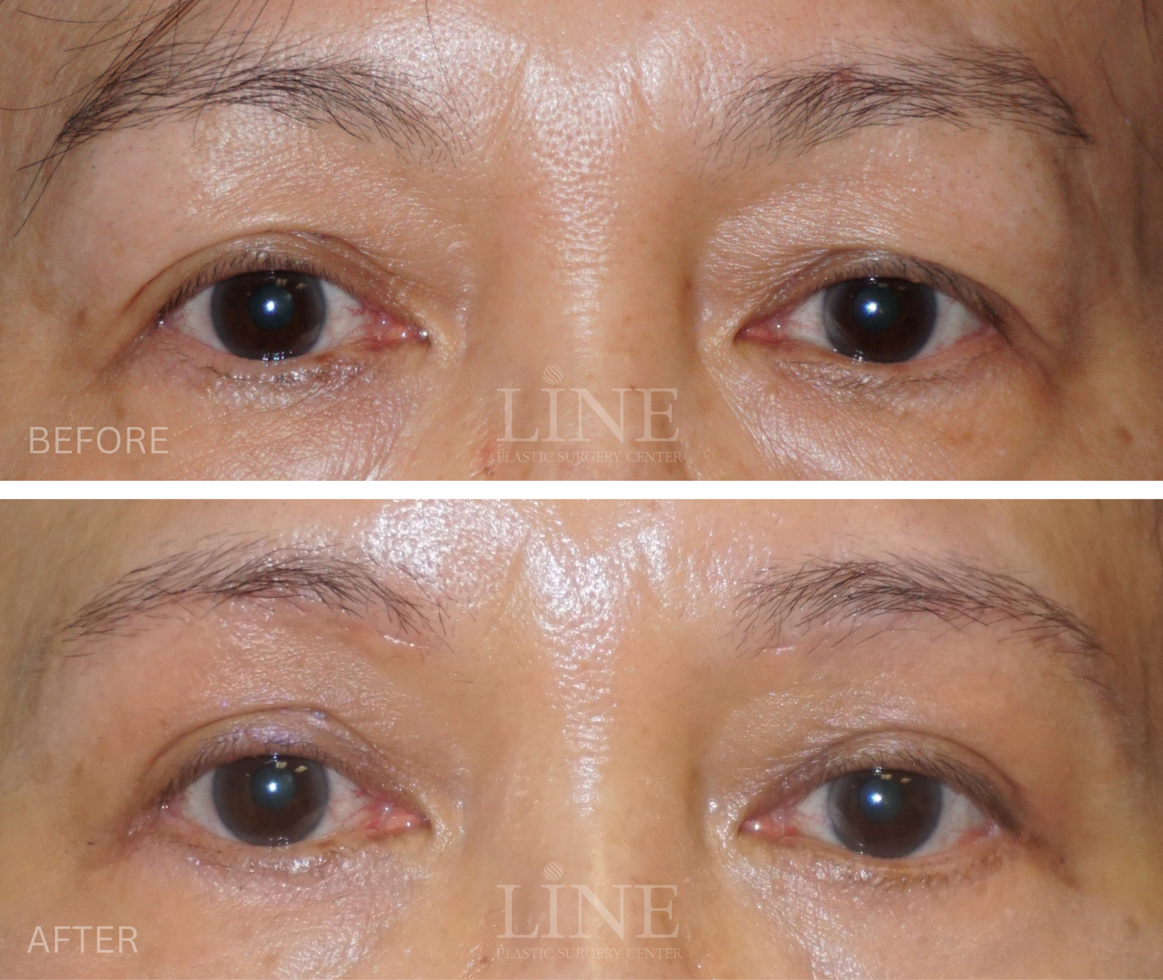 EYE_BROW (5)
