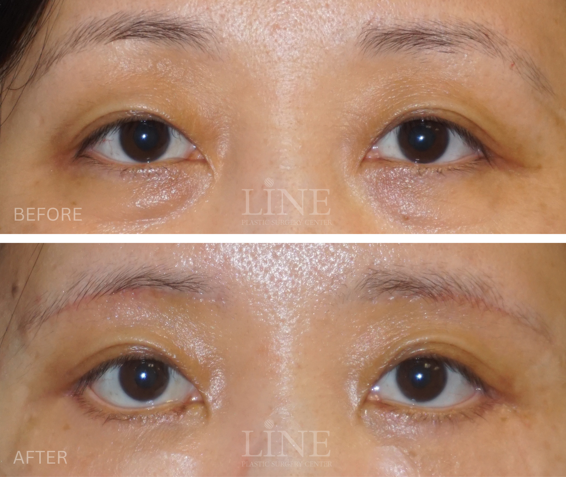 EYE_BROW (6)