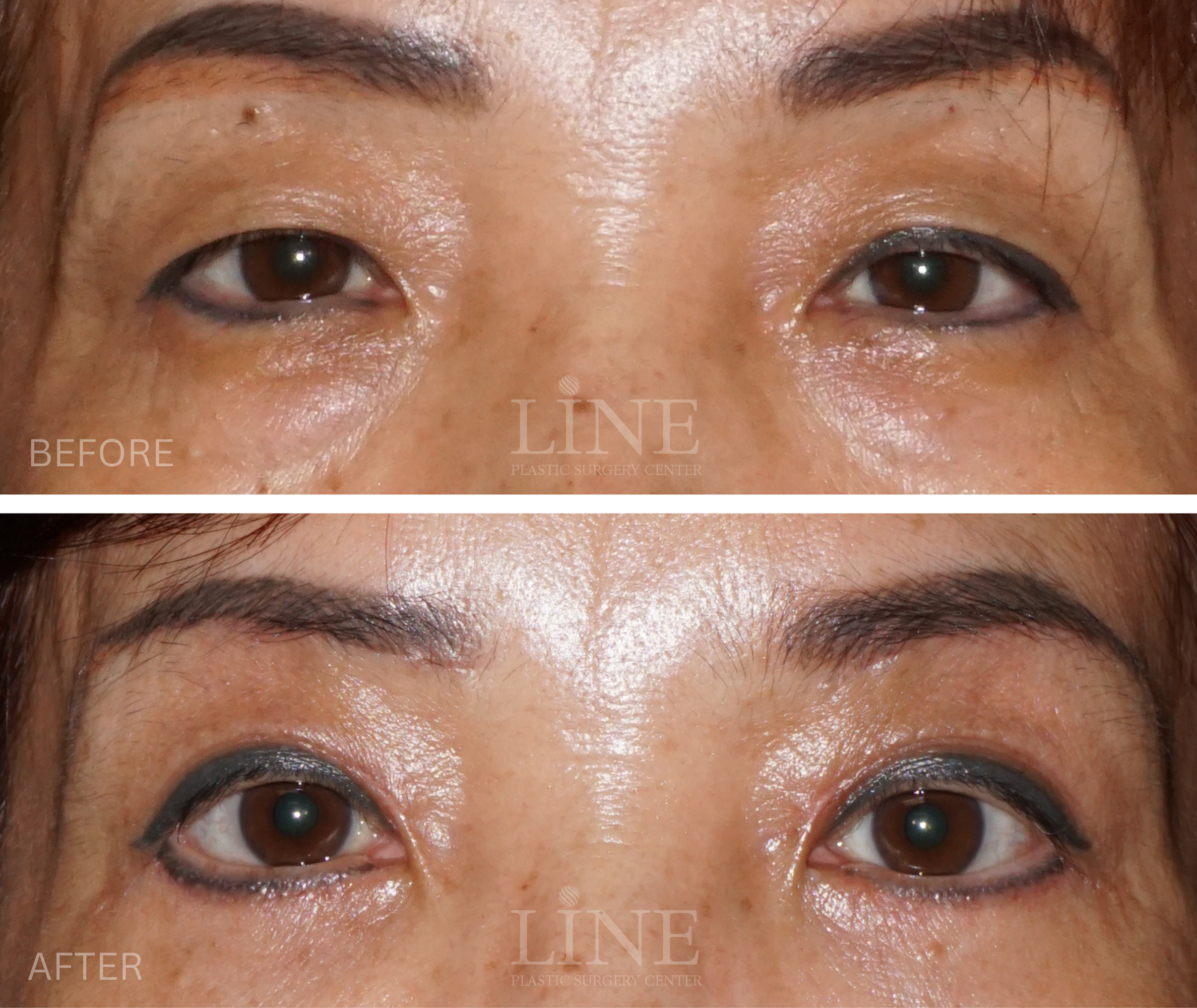 EYE_BROW (7)