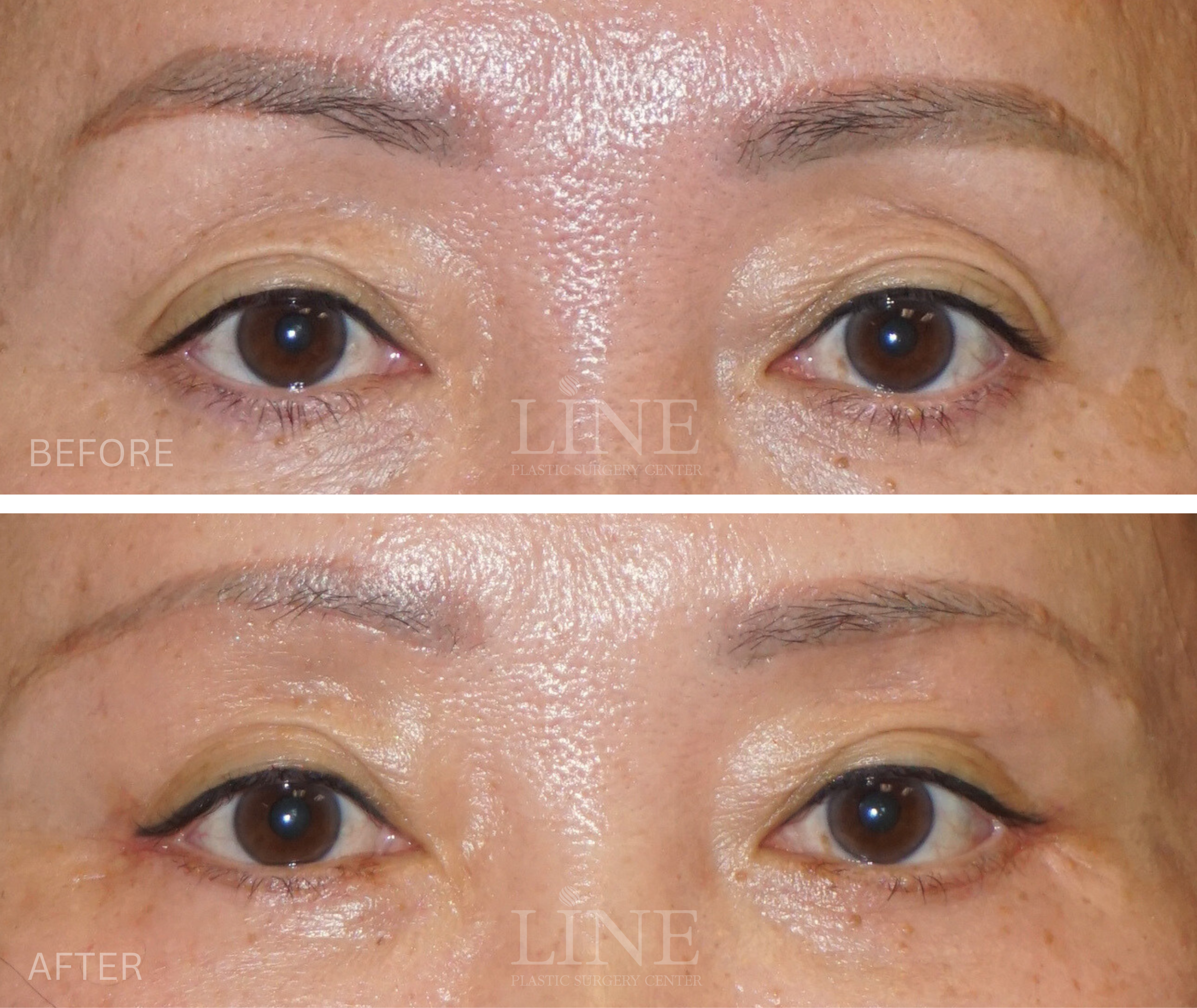 EYE_BROW (9)