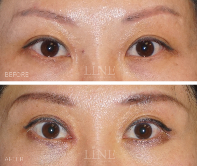 EYE_BROW (17)