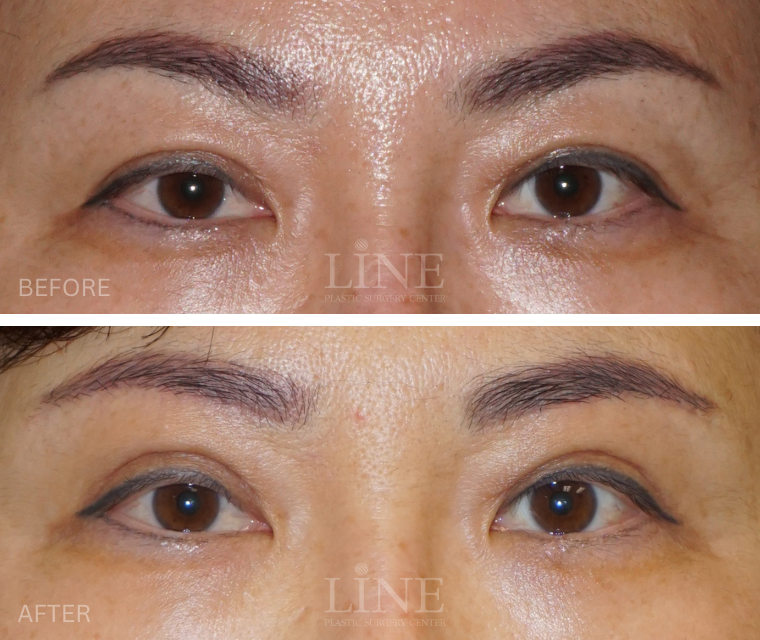EYE_BROW (18)